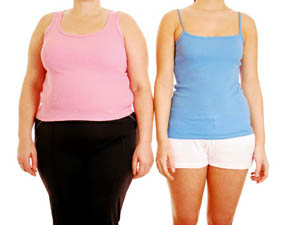 Gastric Band Removal